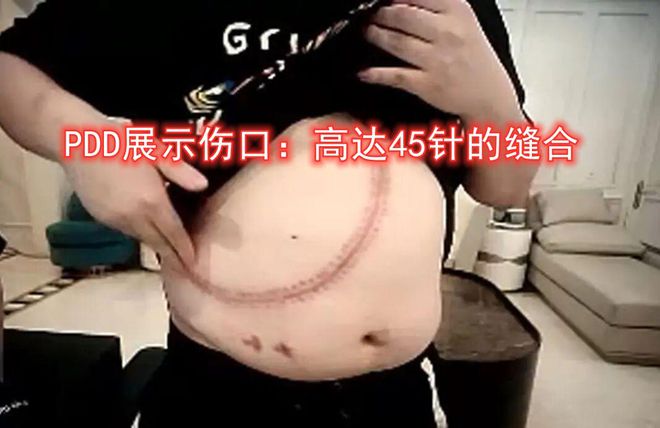 4000名網(wǎng)癮少年電競夢碎：你以為躺著賺錢現(xiàn)實(shí)比高考還殘酷！(圖7)